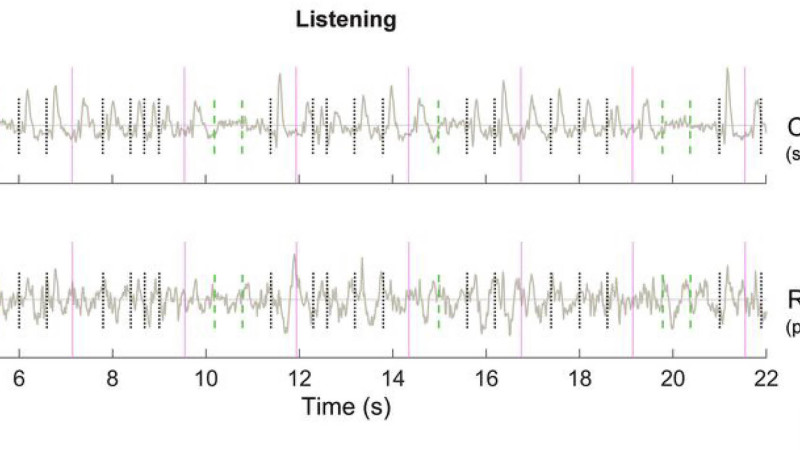 La Prédiction des oscillations